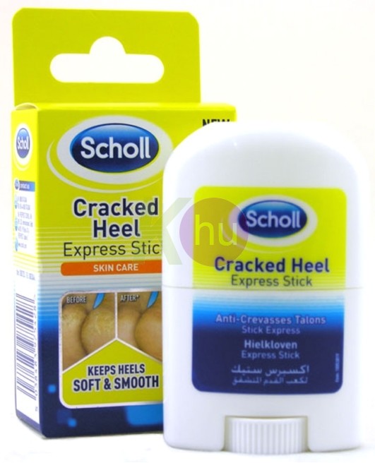 Scholl stift 21g Sarokrepedezés ellen 24962435